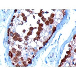 T-Complex 1 (TCP1) Antibody