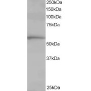 abx433351 staining (1 µg/ml) of Human Lung lysate (RIPA buffer, 35 µg total protein per lane). Detected by chemiluminescence.