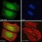Telomerase Reverse Transcriptase (TERT) Antibody