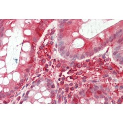 Dimethyladenosine Transferase 2, Mitochondrial (TFB2M) Antibody