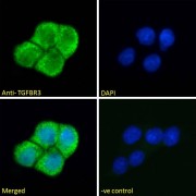 Immunofluorescence analysis of paraformaldehyde fixed A431 cells, permeabilized with 0.15% Triton. Primary incubation 1hr (10 µg/ml) followed by AF488 secondary antibody (2 µg/ml), showing cytoplasmic staining. The nuclear stain is DAPI (blue). Negative control: Unimmunized goat IgG (10 µg/ml) followed by AF488 secondary antibody (2 µg/ml).