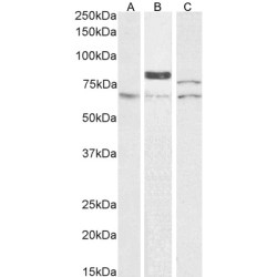 Protein-Glutamine Gamma-Glutamyltransferase 2 (TGM2) Antibody