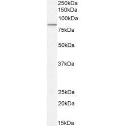 Protein-Glutamine Gamma-Glutamyltransferase 2 (TGM2) Antibody