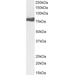 Protein-Glutamine Gamma-Glutamyltransferase 2 (TGM2) Antibody