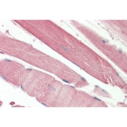 Threonine Synthase Like 2 (THNSL2) Antibody