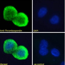 Thrombospondin 1 (THBS1) Antibody