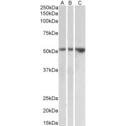 abx433377 (2 µg/ml) staining of Kidney (A), Testis (B) and Uterus (C) lysates (35 µg protein in RIPA buffer). Primary incubation was 1 hour. Detected by chemiluminescence.