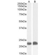 Western blot analysis of extracts of A549 (A) and K562 (B) cell lysate (35 µg protein in RIPA buffer) using TIRAP antibody (0.3 µg/ml).