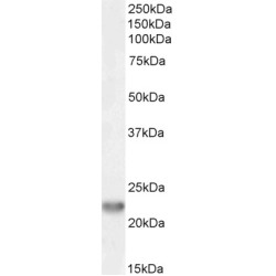 Toll/interleukin-1 Receptor Domain-Containing Adapter Protein (TIRAP) Antibody