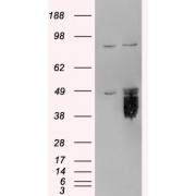 HEK293 overexpressing TFPI and probed with abx433382 (mock transfection in first lane).