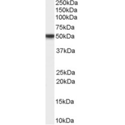 Tissue Factor Pathway Inhibitor (TFPI) Antibody