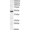 Transmembrane Protease Serine 4 (TMPRSS4) Antibody
