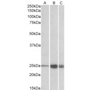 abx433388 (1 µg/ml) staining of Human (A), Mouse (B) and Rat (C) Skeletal Muscle lysate (35 µg protein in RIPA buffer). Primary incubation was 1 hour. Detected by chemiluminescence.