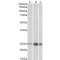 Troponin I, Fast Skeletal Muscle (TNNI2) Antibody