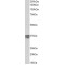 Slow Skeletal Muscle Troponin T (TNNT1) Antibody