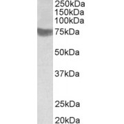 abx433401 (1 µg/ml) staining of Human Skeletal Muscle lysate (35 µg protein in RIPA buffer). Primary incubation was 1 hour. Detected by chemiluminescence.