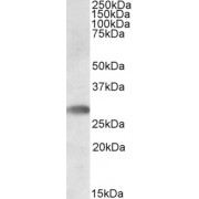 abx433403 staining (0.5 µg/ml) of Human Bone Marrow lysate (RIPA buffer, 35 µg total protein per lane). Primary incubated for 1 hour. Detected by western blot using chemiluminescence.