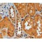 Tripartite Motif-Containing Protein 11 (TRIM11) Antibody
