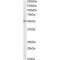 Thyroid Receptor-Interacting Protein 6 (TRIP6) Antibody