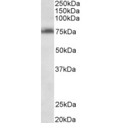 abx433419