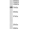 TSPY Like 2 (TSPYL2) Antibody