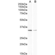 abx433424 (1 µg/ml) staining of Rat Adipose (A) and (0.5 µg/ml) Skeletal Muscle (B) lysate (35 µg protein in RIPA buffer) Detected by chemiluminescence.