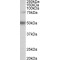 Unc-51 Like Kinase 3 (ULK3) Antibody