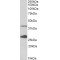 Uroporphyrinogen III Decarboxylase (UROD) Antibody