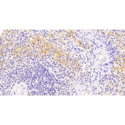 Vav 3 Oncogene (VAV3) Antibody
