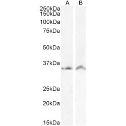 Voltage-Dependent Anion-Selective Channel Protein 2 (VDAC2) Antibody