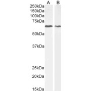 abx433505 (2 µg/ml) staining of MCF7 (A) and NIH3T3 (B) cell lysate (35 µg protein in RIPA buffer). Detected by chemiluminescence