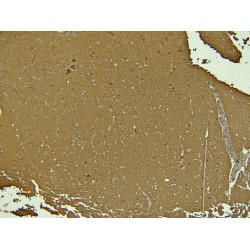 Doublecortex (DCX) Antibody