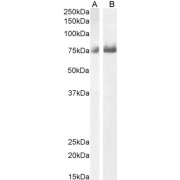 abx433575 (0.5 µg/ml) staining of Mouse (A) and Rat (B) Kidney lysate (35 µg protein in RIPA buffer). Primary incubation was 1 hour. Detected by chemiluminescence.