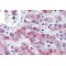 5'-AMP-Activated Protein Kinase Subunit Beta-2 (PRKAB2) Antibody