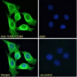 Toll Like Receptor 4 (TLR4) Antibody
