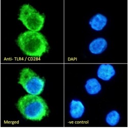 Toll Like Receptor 4 (TLR4) Antibody
