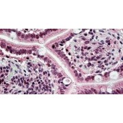 IHC-P analysis of Human small intestine tissue, using Excision Repair Cross-Complementing Rodent Repair Deficiency, Complementation 6 (ERCC6) Antibody (3.8 µg/ml).