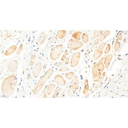 F-Box/WD Repeat-Containing Protein 1A (BTRC) Antibody
