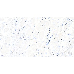 F-Box/WD Repeat-Containing Protein 1A (BTRC) Antibody