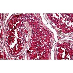 Securin (PTTG1) Antibody