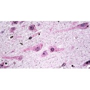 IHC-P analysis of Human brain tissue, using Dicer 1, Ribonuclease Type III (DICER1) Antibody (3.8 µg/ml).