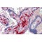 Coagulation Factor XIII A Chain (F13A1) Antibody