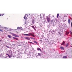 Coagulation Factor XIII A Chain (F13A1) Antibody