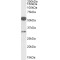 Estrogen Receptor Beta (ESR2) Antibody
