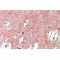 Vesicular Glutamate Transporter 1 (SLC17A7) Antibody