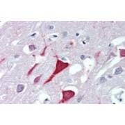 IHC-P analysis of Human cortex tissue, using Probable Ubiquitin Carboxyl-Terminal Hydrolase FAF-X (USP9X) Antibody (3.8 µg/ml).