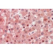 IHC-P analysis of Human liver tissue, using N/ARas Association Domain-Containing Protein 1 (RASSF1) Antibody (3.75 µg/ml).