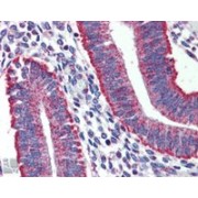 IHC-P analysis of Human uterus tissue, using TYRO Protein Tyrosine Kinase-Binding Protein (TYROBP) Antibody (3 µg/ml).