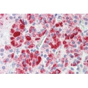 IHC-P analysis of Human adrenal cortex tissue, using Clathrin Heavy Chain 1 (CLTC) Antibody (3.75 µg/ml).