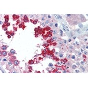 abx433664